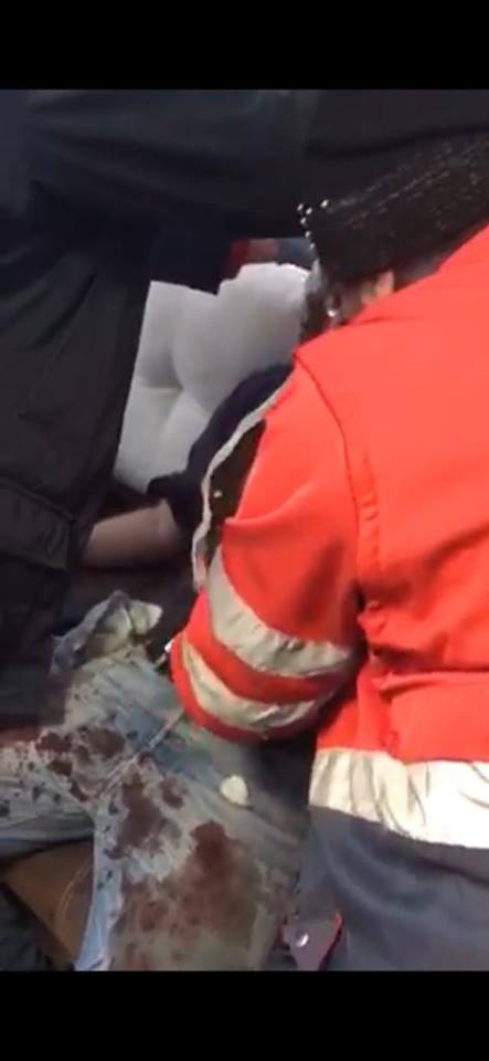 В Харькове неизвестные в масках напали на полицейского: офицер получил тяжелые ранения (фото)