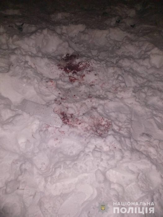 В Харькове мужчине фейерверком оторвало кисть руки