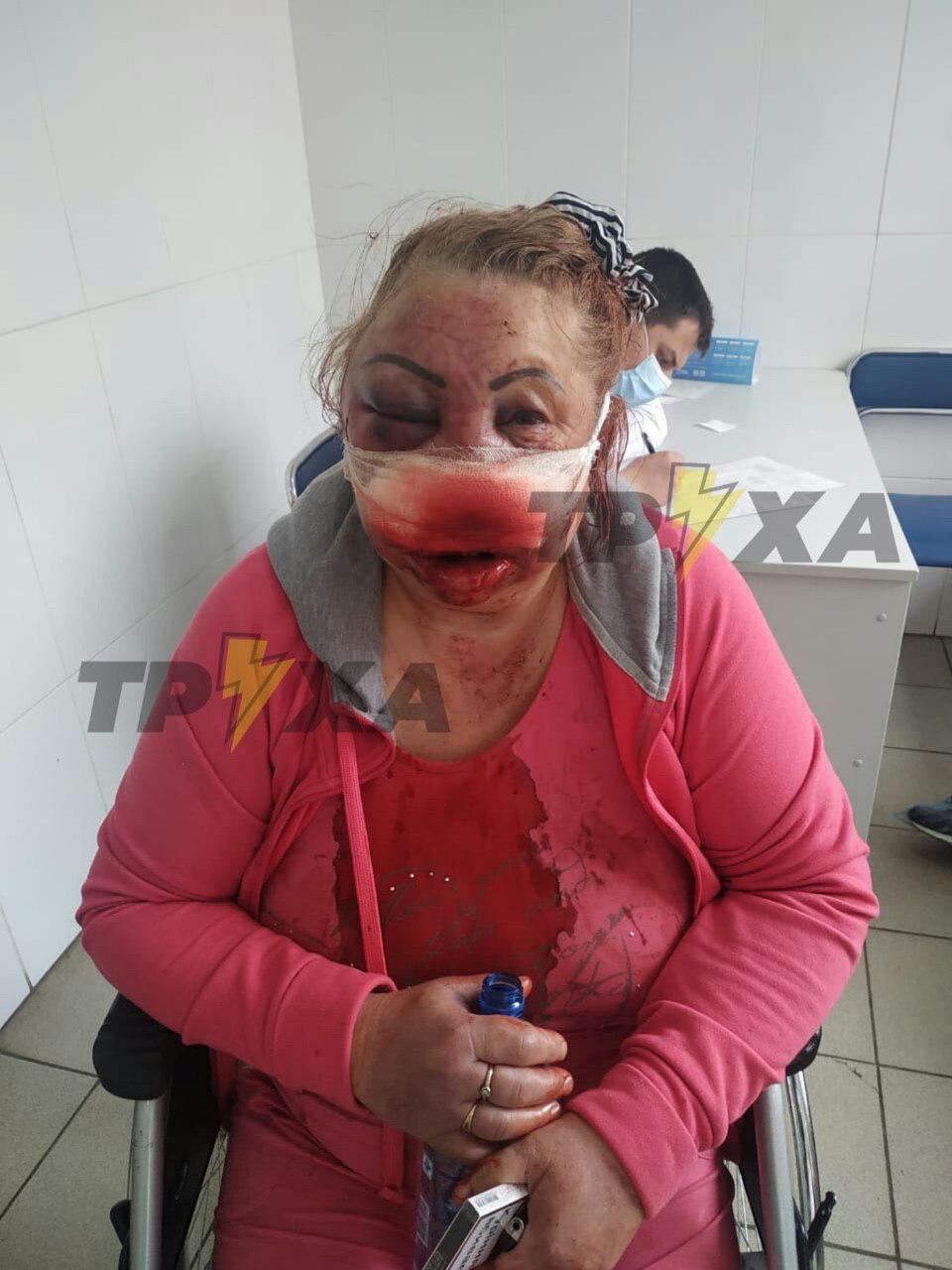 На Салтовке неизвестные ворвались в квартиру к женщине, сильно избили ее и ограбили