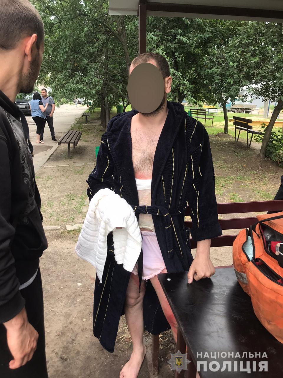 Полицейские задержали мужчину, который поджег автомобиль на Алексеевке