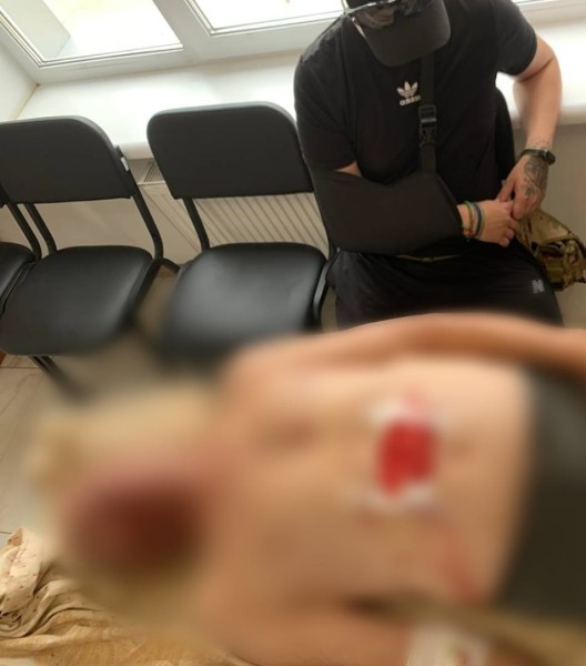 У Чугуївському районі місцевий житель підірвався на ворожій міні: поліція встановлює обставини події