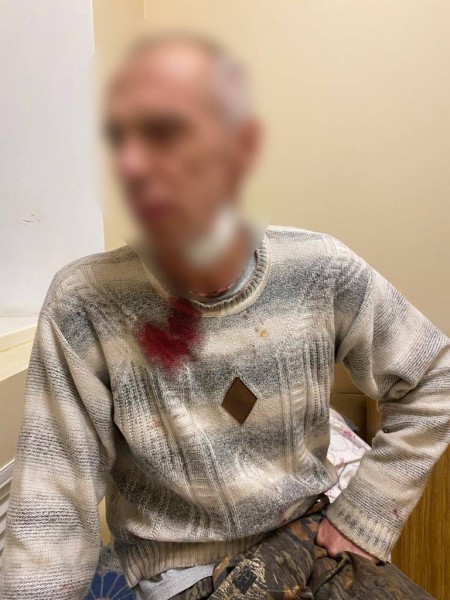 На Харківщині затримали чоловіка, який ледь не вбив знайомого