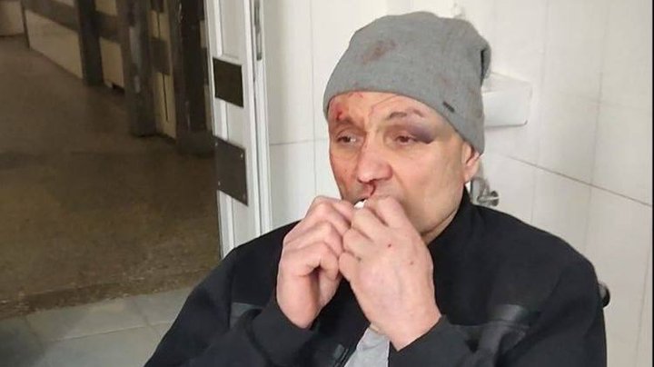Пенсіонер-рятувальник заявляє про побиття у приміщенні ТЦК в Харкові
