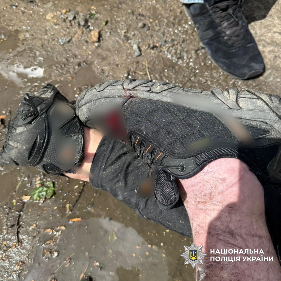 У Чугуєві поліцейські затримали озброєного розбійника, який напав на пенсіонерку